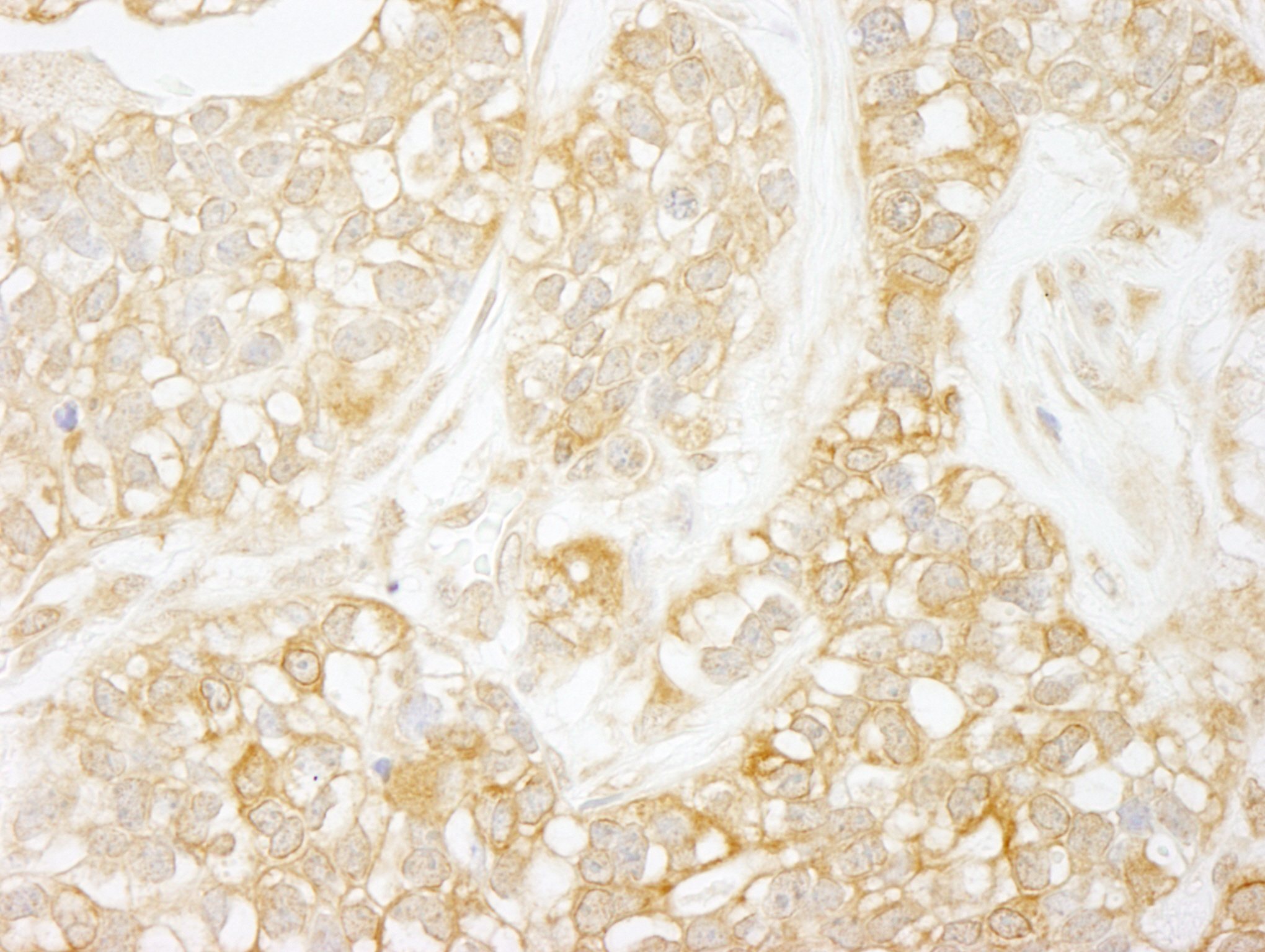 Rabbit anti-RelA IHC Antibody