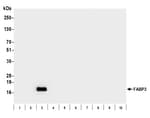 Detection of human FABP3 by western blot.