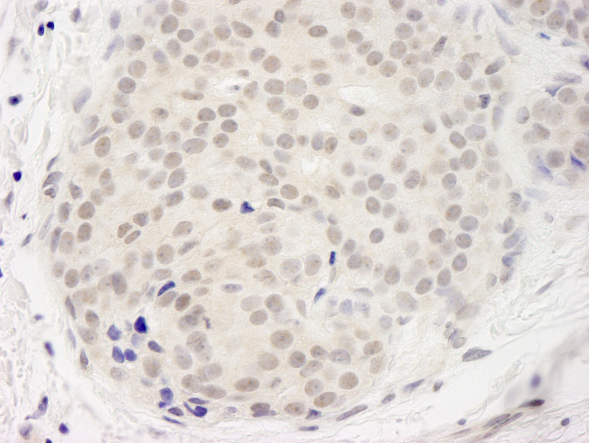 Rabbit anti-DDX23 IHC Antibody