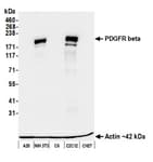 Detection of mouse PDGFR beta by western blot.