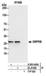 Detection of human SRPRB by western blot of immunoprecipitates.