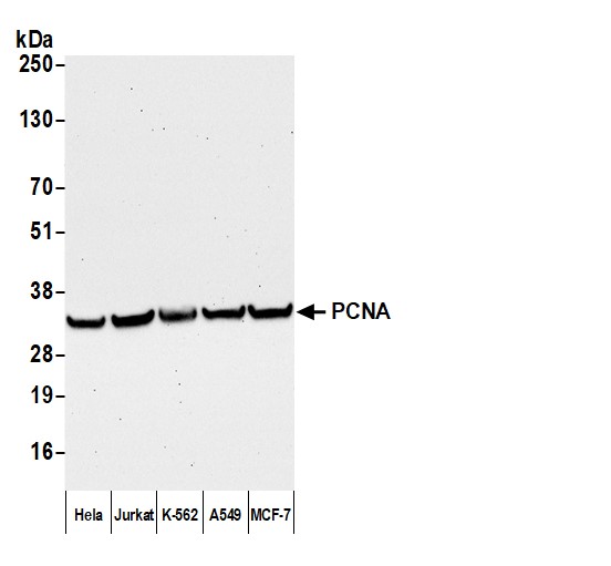 Detection of human PCNA by western blot with Affinity Purified F(ab')2 Goat anti-Mouse IgG Heavy and Light Chain Cross-Adsorbed Antibody.