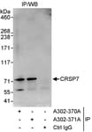 Detection of human CRSP7 by western blot of immunoprecipitates.