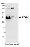 Detection of human SLC46A1 by western blot.