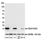 Detection of human CD247/CD3Z by western blot.