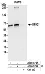 Detection of human S6K2 by western blot of immunoprecipitates.