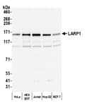 Detection of human LARP1 by western blot.