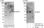 Detection of human NELFE by western blot and immunoprecipitation.