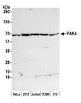 Detection of human and mouse PAK4 by western blot.