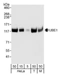 Detection of human and mouse UBE1 by western blot.