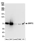 Detection of human and mouse SRP72 by western blot.