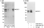 Detection of human DKC1 by western blot and immunoprecipitation.