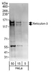 Detection of human Reticulon-3 by western blot.