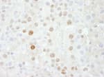 Detection of mouse FOXK1 by immunohistochemistry.