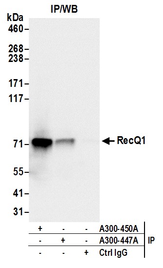 Detection of human RecQ1 by western blot of immunoprecipitates.