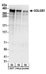Detection of human GOLGB1 by western blot.