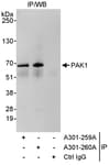 Detection of human PAK1 by western blot of immunoprecipitates.