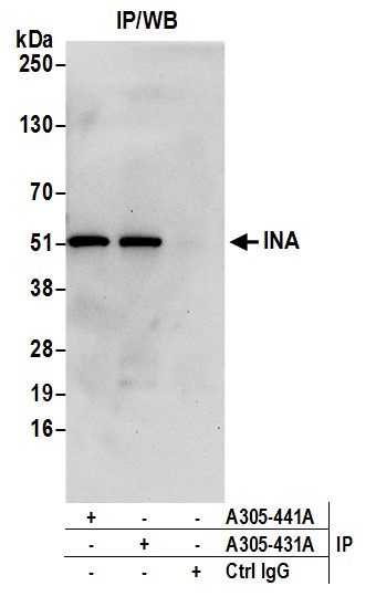 Detection of human INA by western blot of immunoprecipitates.