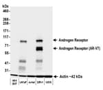 Detection of human Androgen Receptor by western blot.