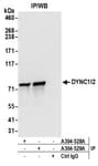 Detection of human DYNC1I2 by western blot of immunoprecipitates.