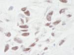 Detection of human PNUTS by immunohistochemistry.