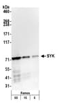 Detection of human SYK by western blot.