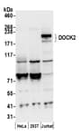 Detection of human DOCK2 by western blot.