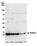 Detection of human and mouse PRDX5 by western blot.