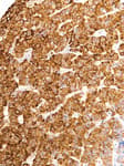 Detection of human LH-B by immunohistochemistry.