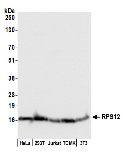 Detection of human and mouse RPS12 by western blot.