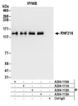 Detection of human RNF216 by western blot of immunoprecipitates.