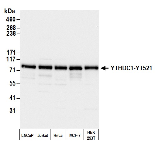Detection of human YTHDC1-YT521 by western blot.
