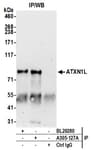 Detection of human ATXN1L by western blot of immunoprecipitates.