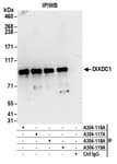 Detection of human DIXDC1 by western blot of immunoprecipitates.