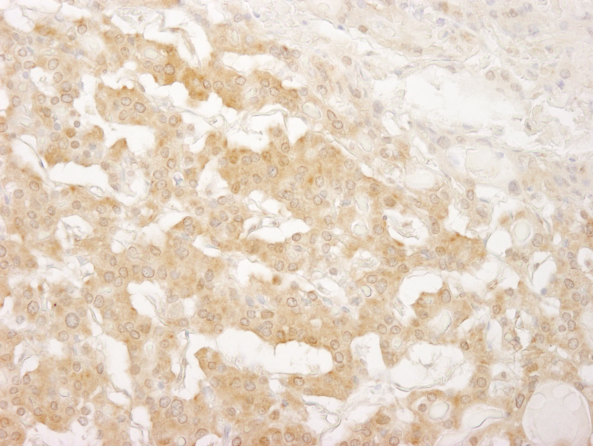 Rabbit anti-IRS1 IHC Antibody Affinity Purified, image 2