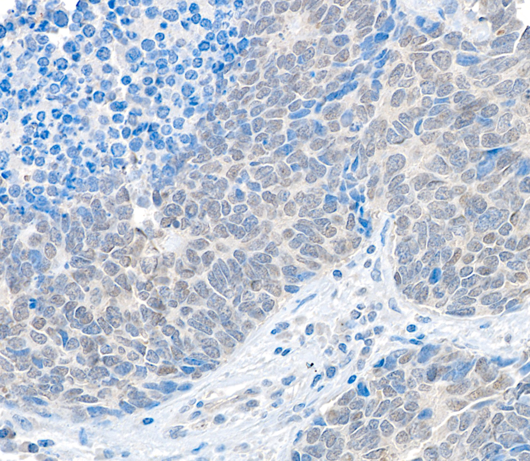 Detection of human USP37 by immunohistochemistry.