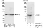 Detection of human LIMD1 by western blot and immunoprecipitation.
