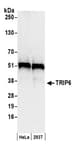 Detection of human TRIP6 by western blot.