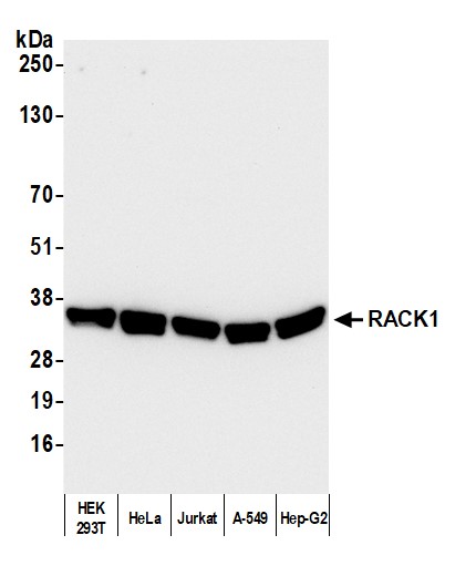 Detection of human RACK1 by western blot.