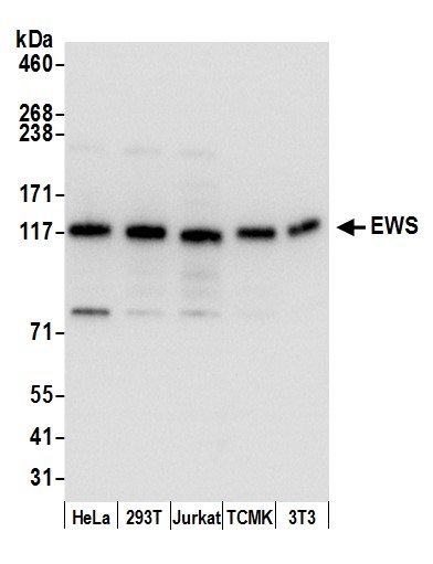 Detection of human and mouse EWS by western blot.