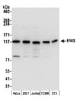 Detection of human and mouse EWS by western blot.