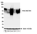 Detection of human PVRL1/NECTIN1 by western blot.
