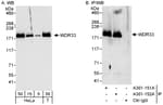 Detection of human WDR33 by western blot and immunoprecipitation.