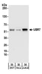 Detection of human UBR7 by western blot.