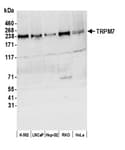 Detection of human TRPM7 by western blot.