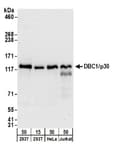 Detection of human DBC1/p30 by western blot.