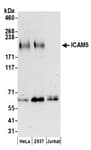 Detection of human ICAM5 by western blot.