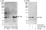 Detection of human and mouse TR2 by western blot (h&amp;m) and immunoprecipitation (h).
