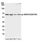 Detection of human SMARCD2/BAF60b by western blot.