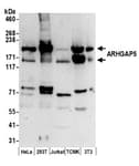 Detection of human and mouse ARHGAP5 by western blot.
